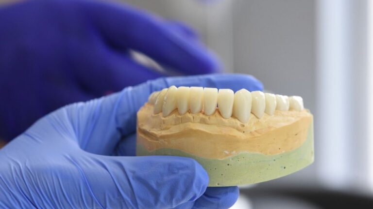 ¿Cuánto cuestan los implantes dentales? Todo lo que necesitas saber